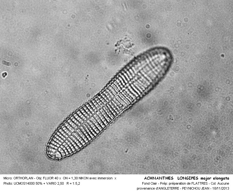 ACHNANTES  LONGIPES major elongata #34797