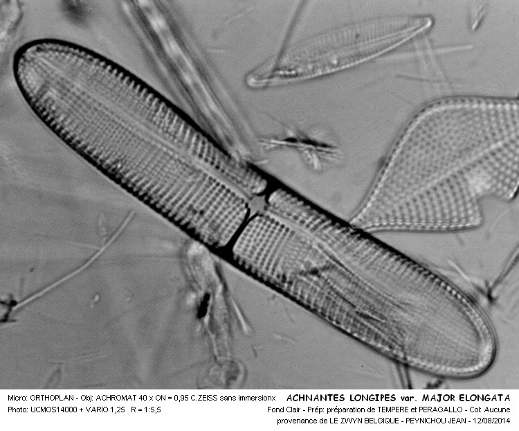 ACHNANTES  LONGIPES major elongata #38491