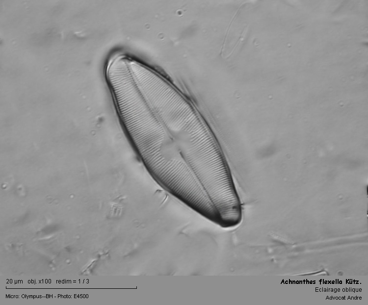 Achnanthes flexella (Kützing) Brun #1929