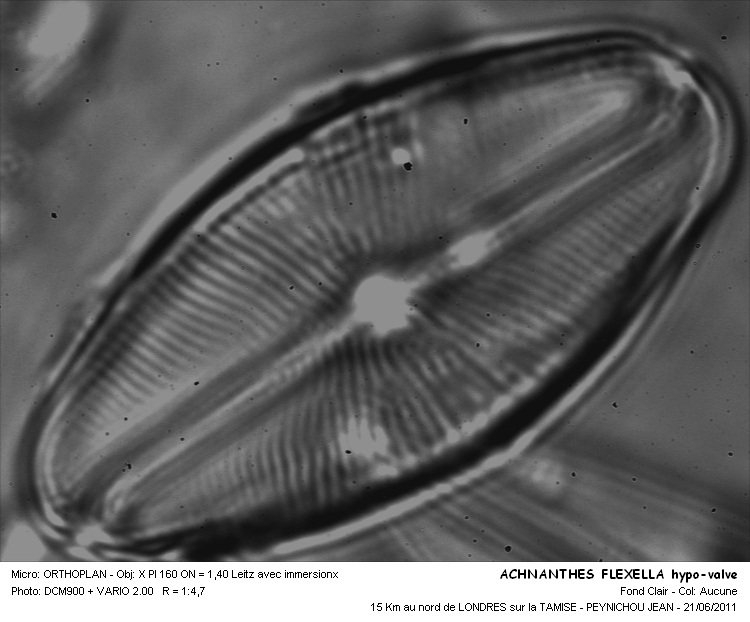 ACHNANTHES FLEXULLUM #31400