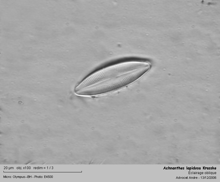 Achnanthes lapidosa Krasske #2112