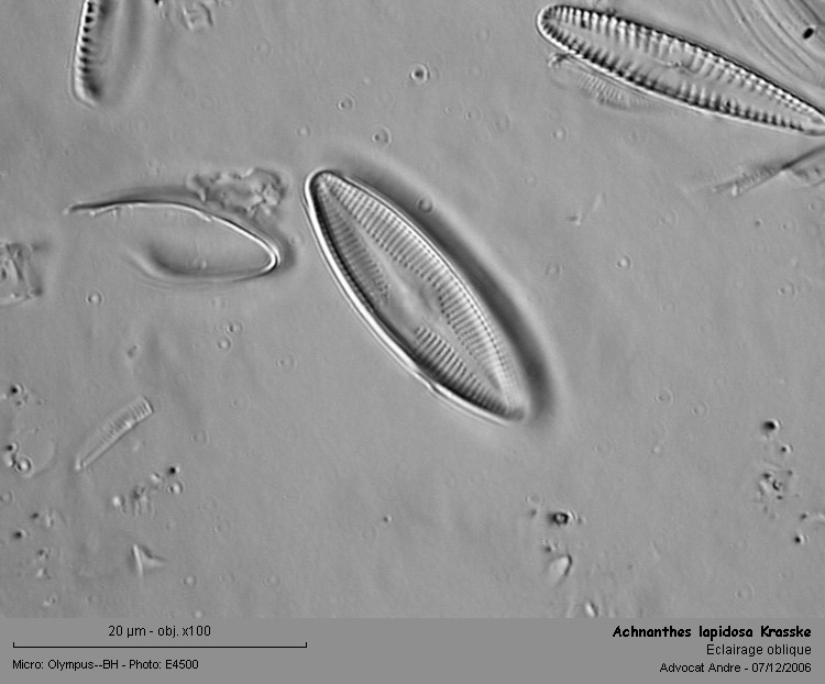 Achnanthes lapidosa Krasske #2111