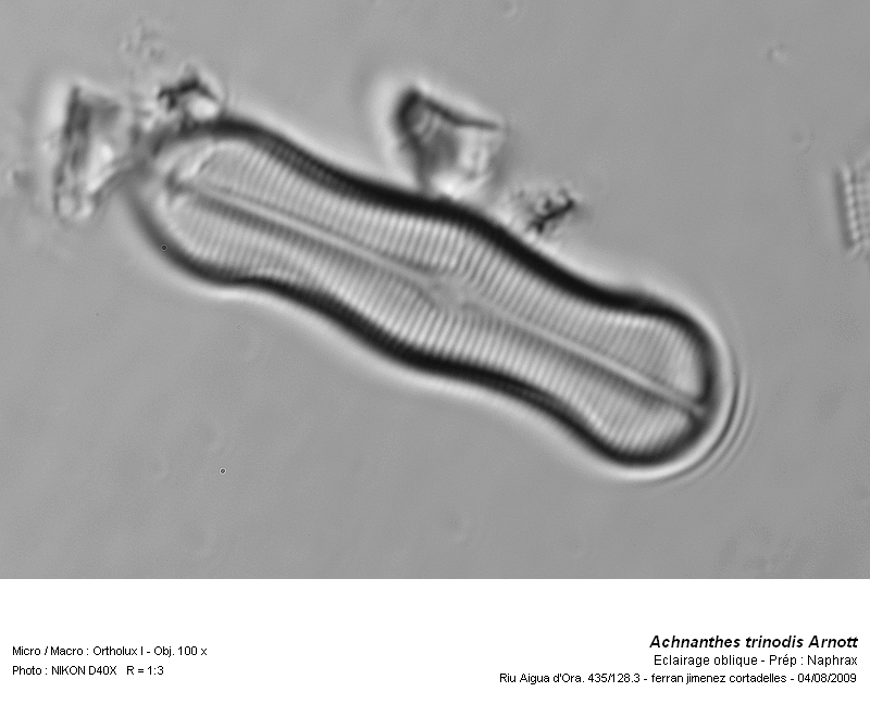 Achnanthes trinodis Arnott #14285