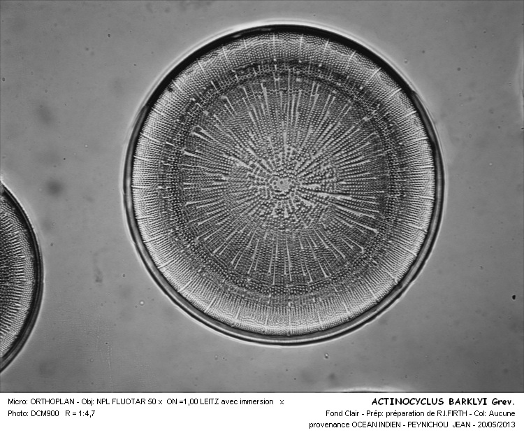 Actinocyclus Barklyi Variantes d´observation #33132