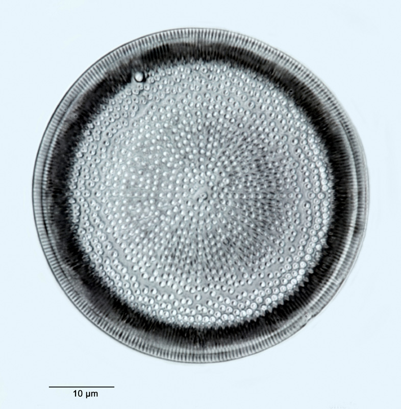 Actinocyclus ehrenbergii Ralfs #32639