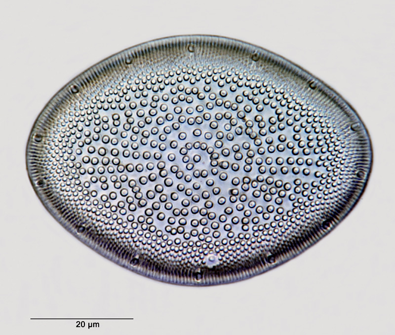 Actinocyclus ellipticus Grunow in Van Heurck #30555