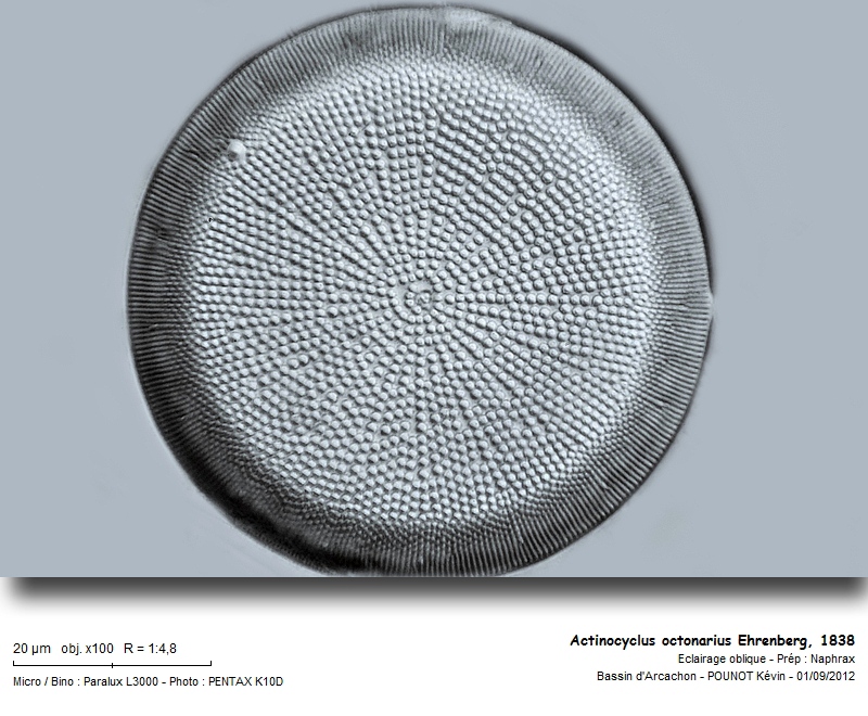 Actinocyclus octonarius Ehrenberg, 1838 #28096