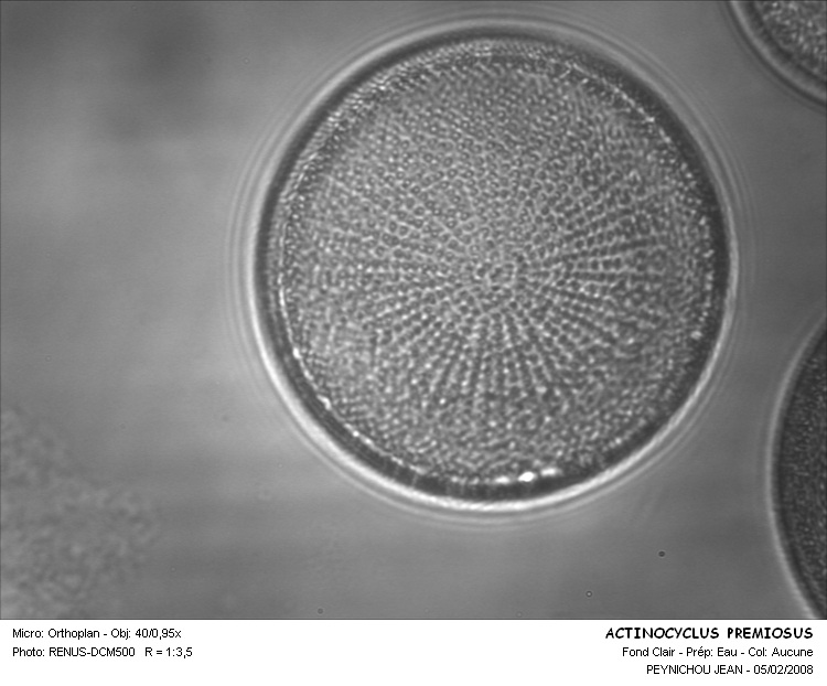 ACTINOCYCLUS PREMIOSUS #30584