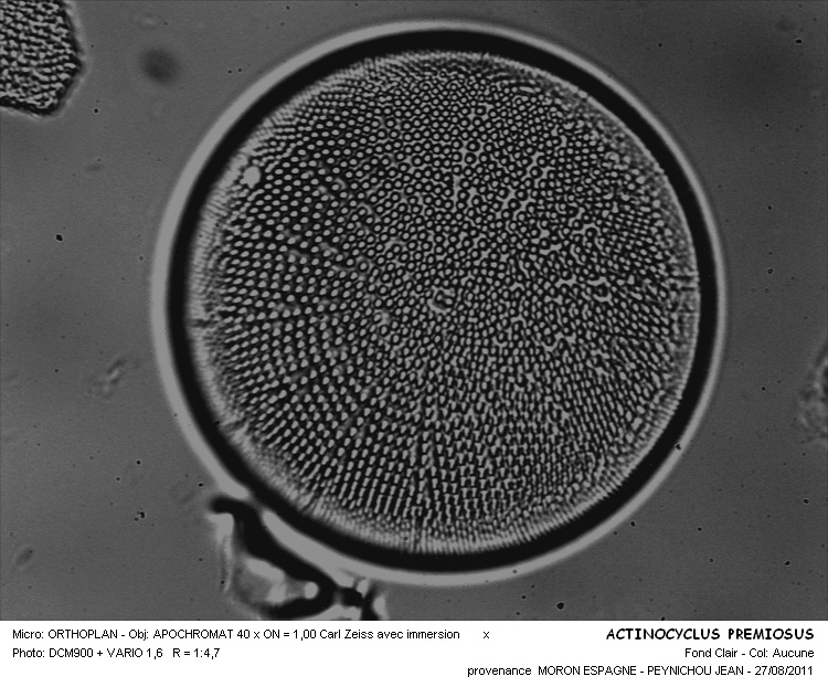 ACTINOCYCLUS PREMIOSUS #30583