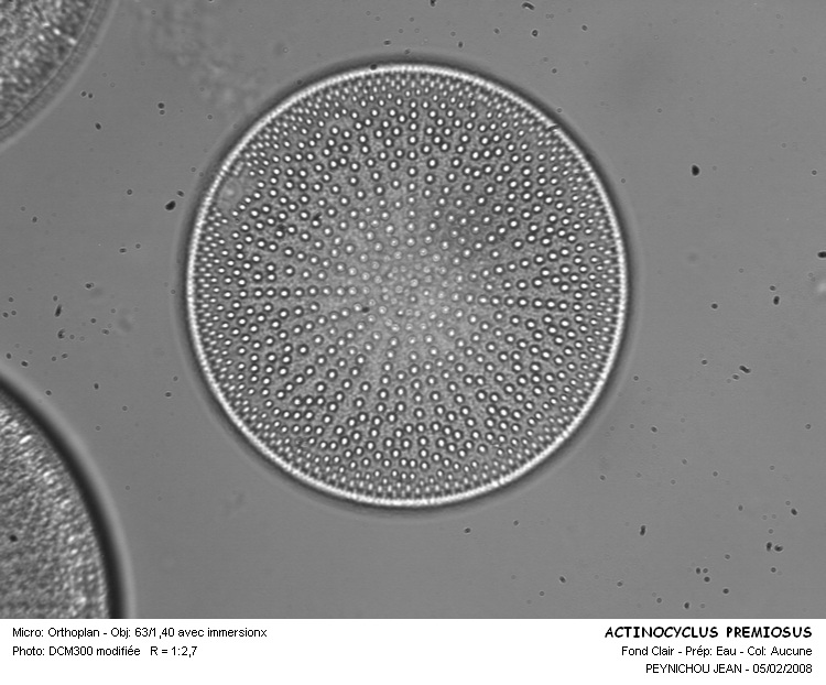ACTINOCYCLUS PREMIOSUS #30585