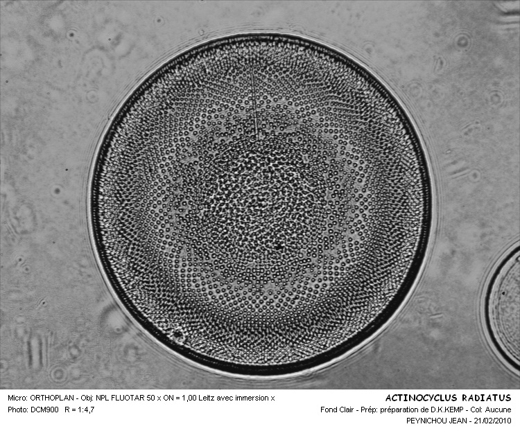 ACTINOCYCLUS RADIATUS #31287