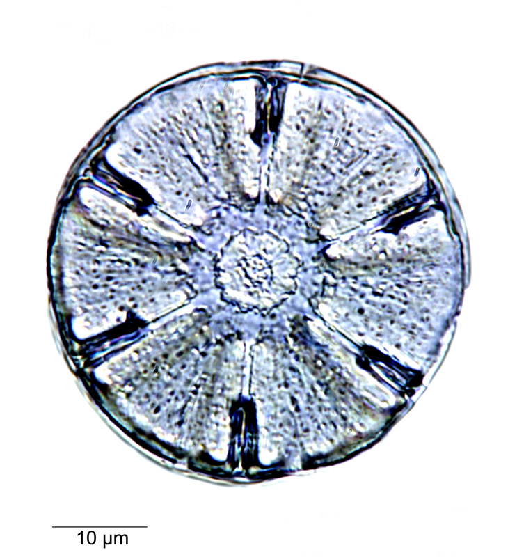 Actinodictyon weissflogii #79757