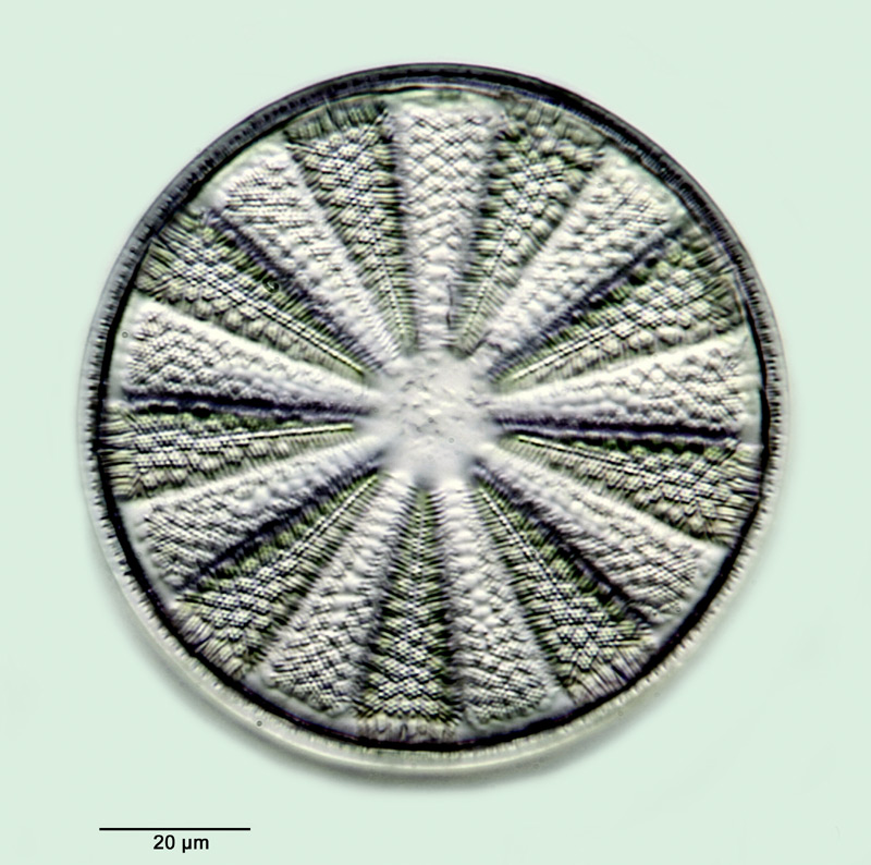 Actinoptychus glabratus Grunow var. andesitica Pantocsek #32669