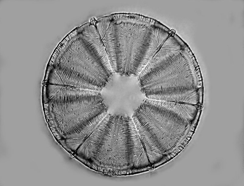 Actinoptychus interpositus  Brun #35319