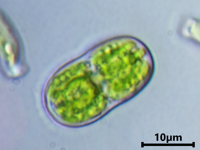 Actinotaenium cruciferum (De Bary) Teiling, 1954 #79162