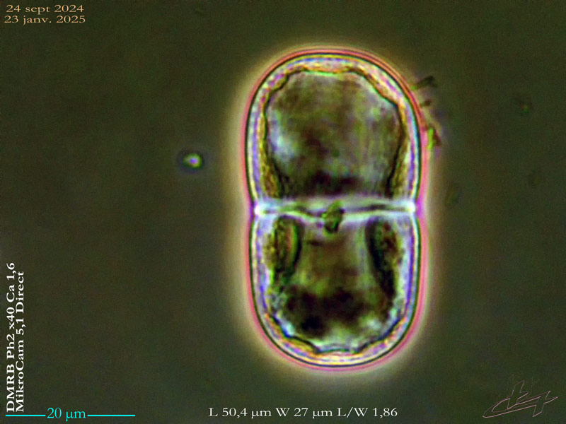 Actinotaenium cucurbita #81297