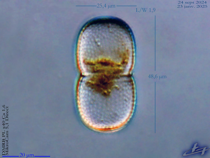 Actinotaenium cucurbita #81298