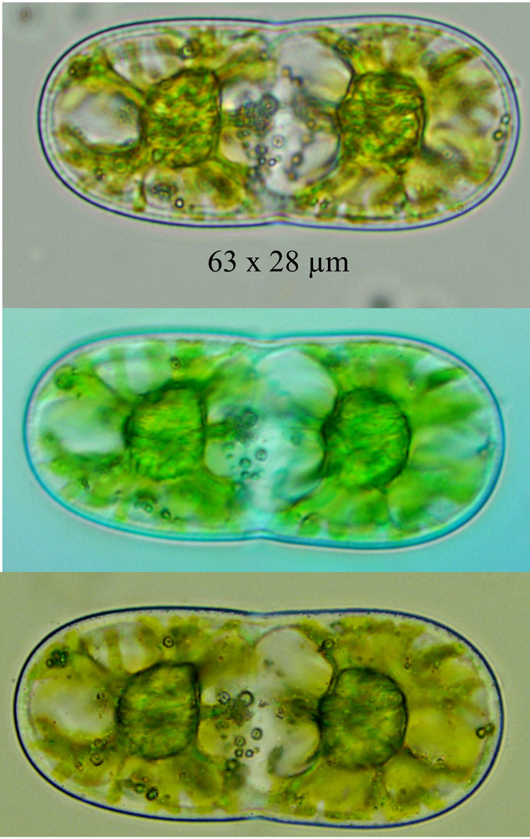 Actinotaenium diplosporum #60930