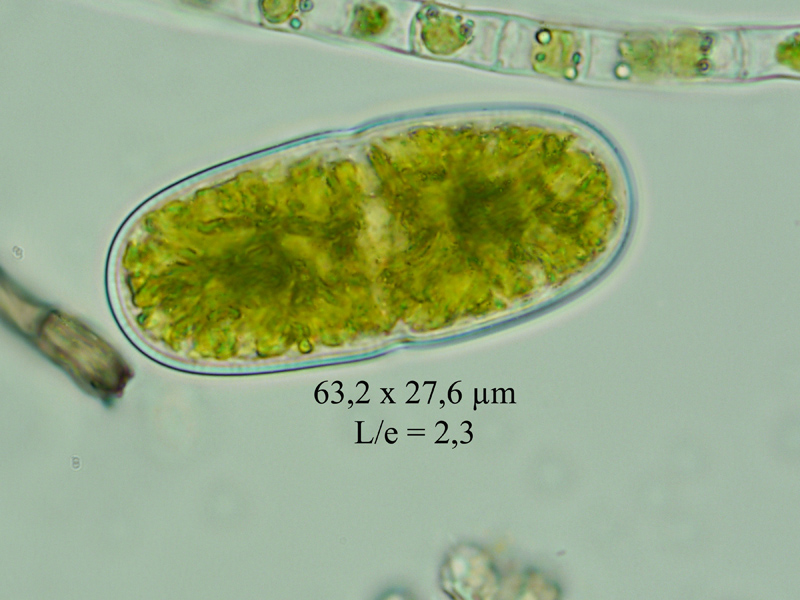 Actinotaenium diplosporum #60847