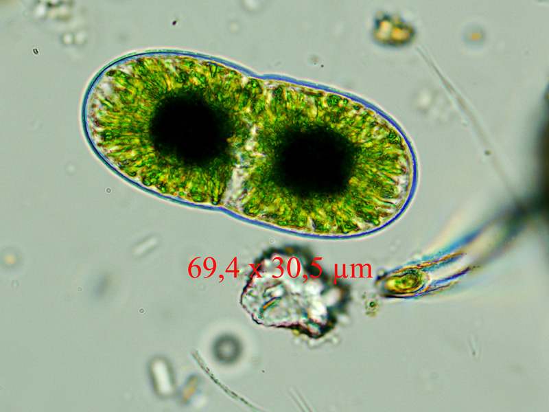 Actinotaenium diplosporum #60848