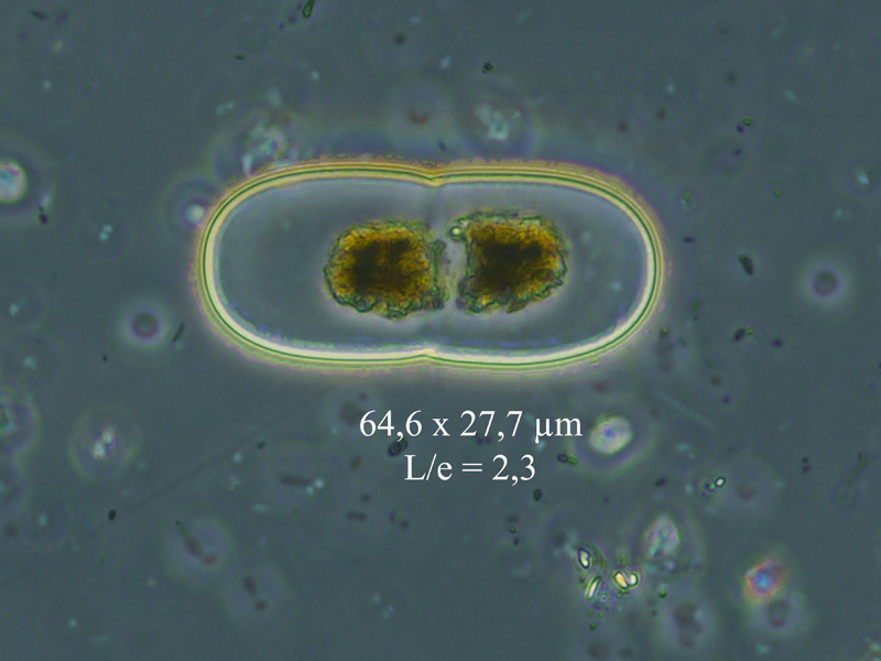 Actinotaenium diplosporum #60849