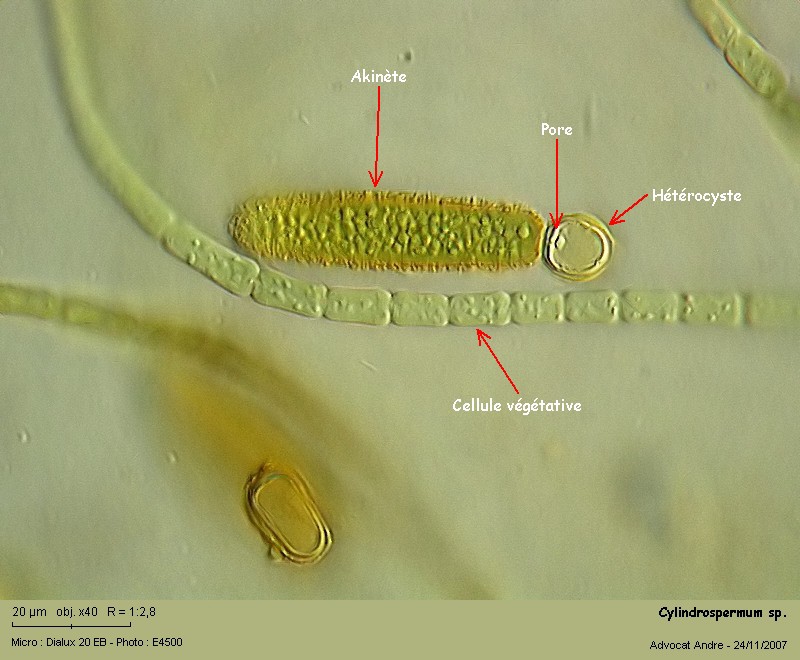 Akinètes, fonction de multiplication chez les Cyanobactéries #54396