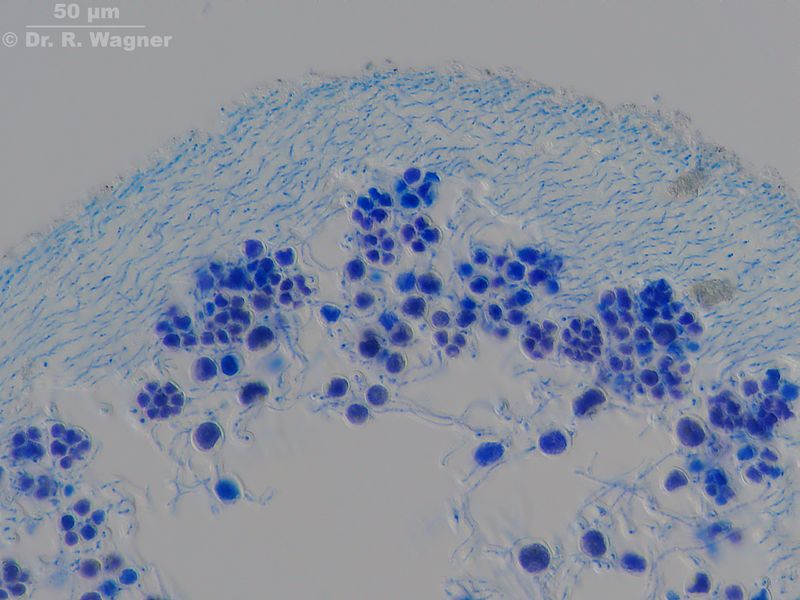 Alectoria ochroleuca #20450