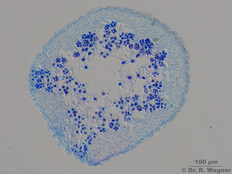 Alectoria ochroleuca #20449