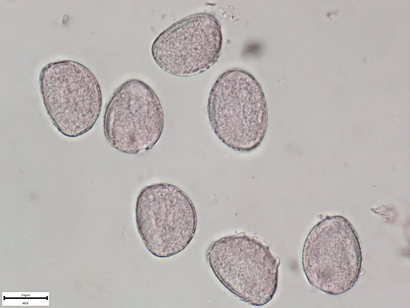 Allium ursinum L., 1753 - pollen #70225