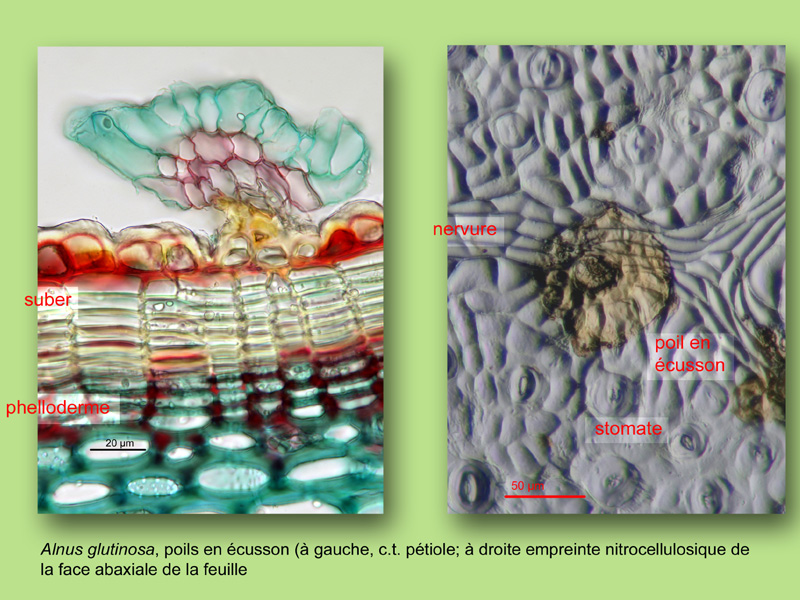 Alnus glutinosa, histologie, histology. #25011