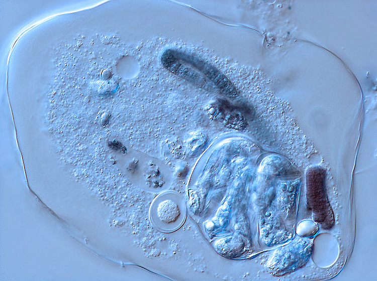 Amoeba terricola (ou verrucosa) #1214