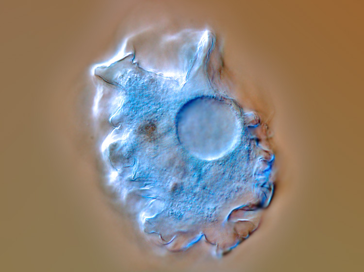 Amoeba terricola (ou verrucosa) #1212