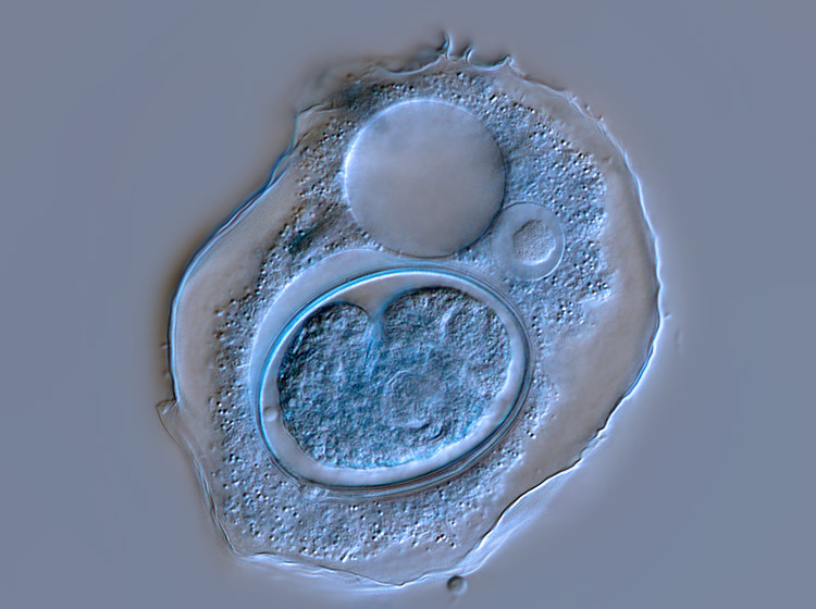 Amoeba terricola (ou verrucosa) #1210