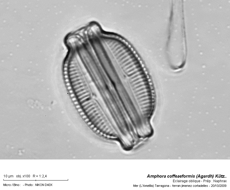 Amphora coffeaeformis (Agardh) Kütz. #12948