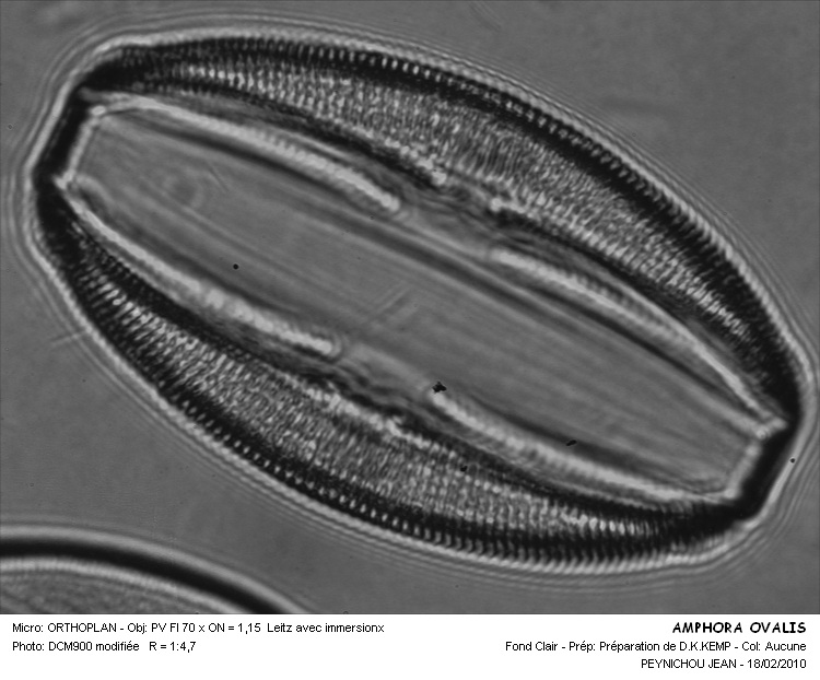 AMPHORA OVALIS #32304