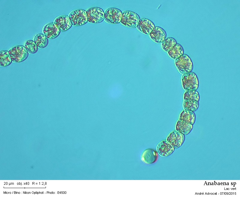 Anabaena sp.  -- ( dans les Vosges, lac vert ) #42127