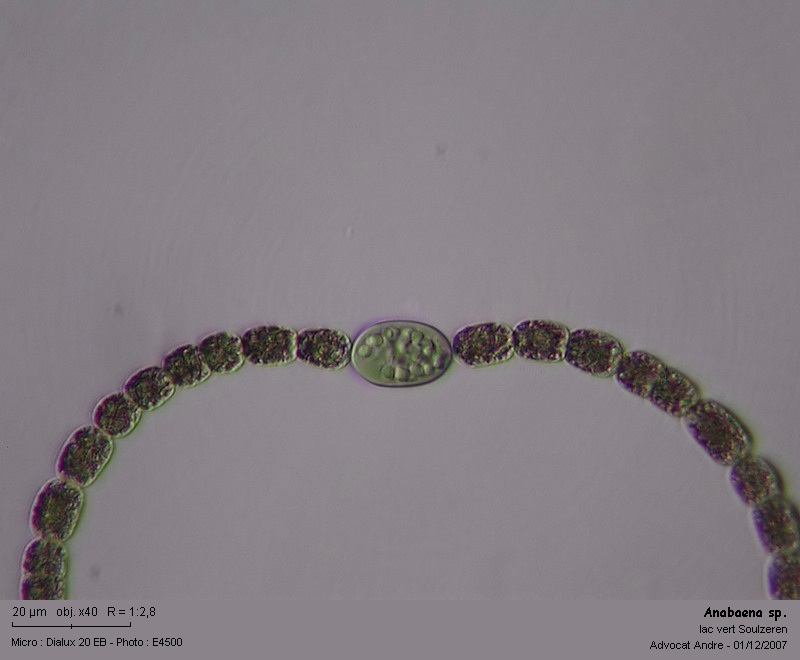 Anabaena sp.  -- ( dans les Vosges, lac vert ) #1039