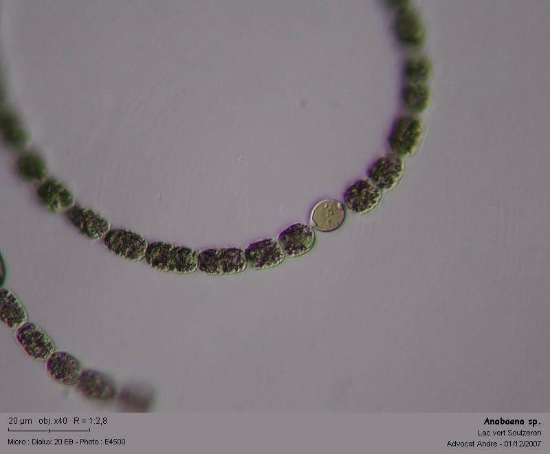 Anabaena sp.  -- ( dans les Vosges, lac vert ) #1037