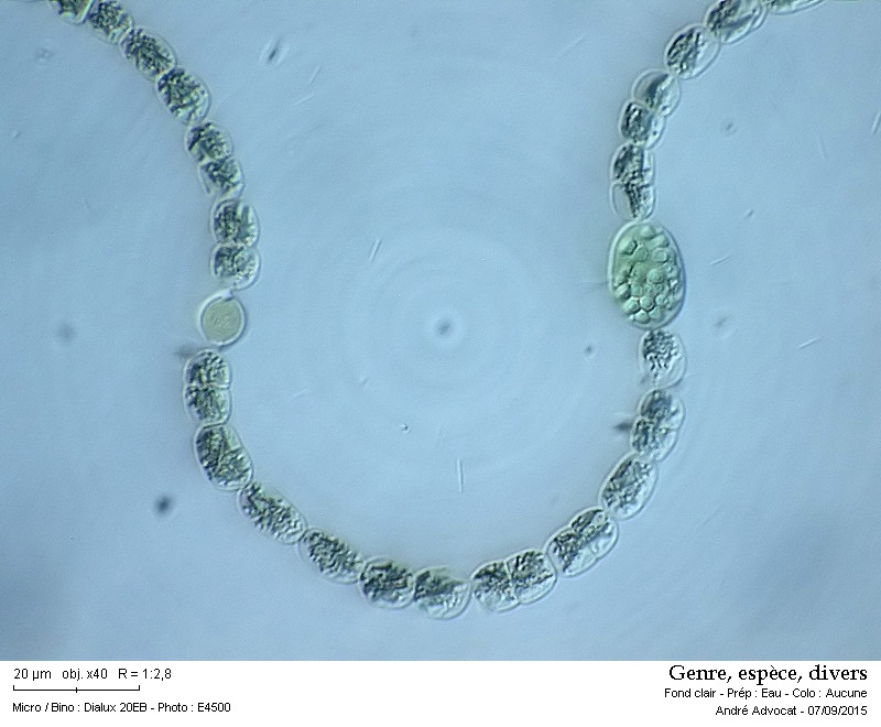 Anabaena sp.  -- ( dans les Vosges, lac vert ) #42125