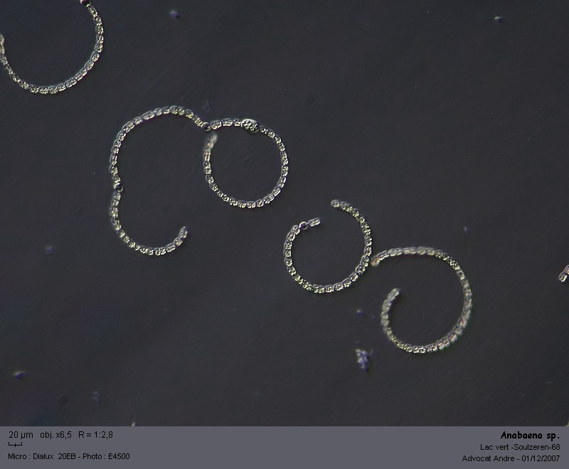 Anabaena sp.  -- ( dans les Vosges, lac vert ) #1035