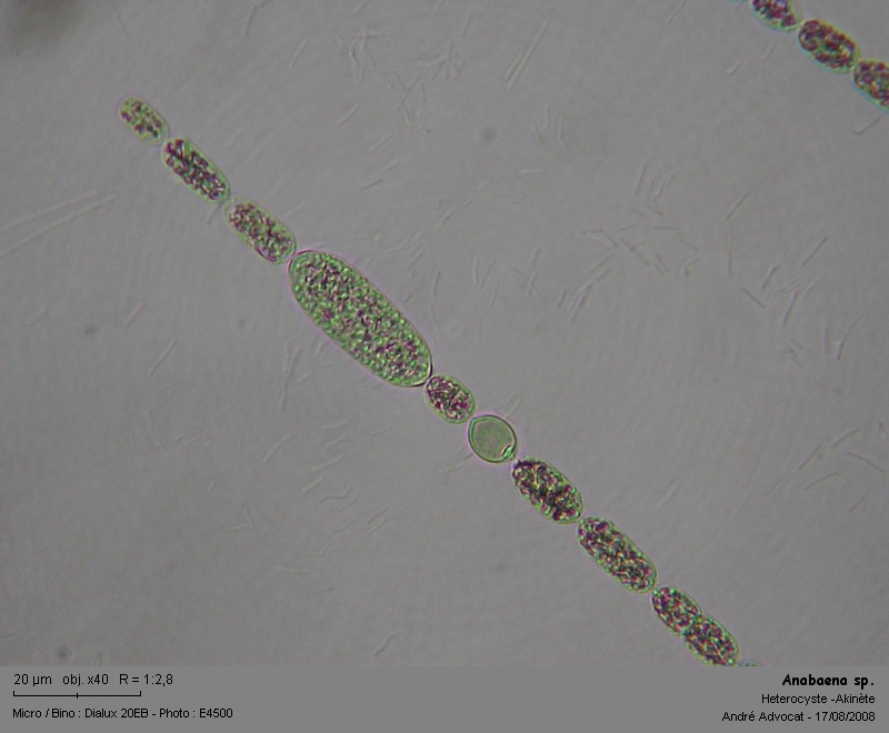 Anabaena sp. ( dans les Vosges, lac du Forlet ) #5229