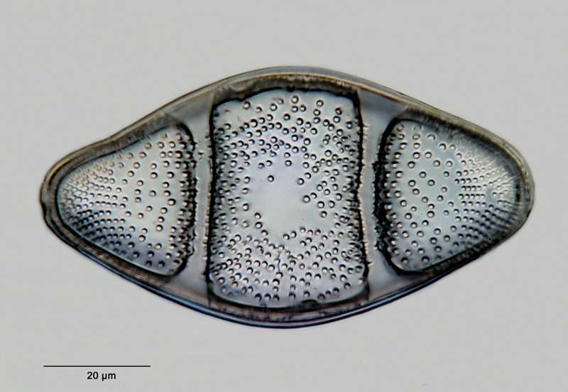 Anaulus fossus (Gr. & St.) Grunow #27790