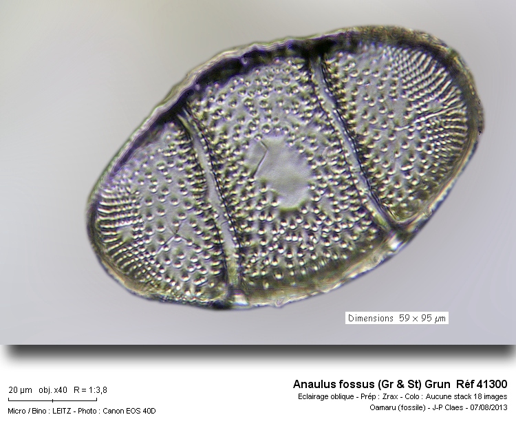 Anaulus fossus #33155