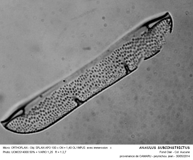 ANAULUS SUBCONSTRICTUS #37706