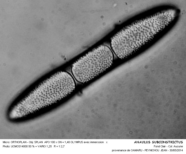 ANAULUS SUBCONSTRICTUS #37705