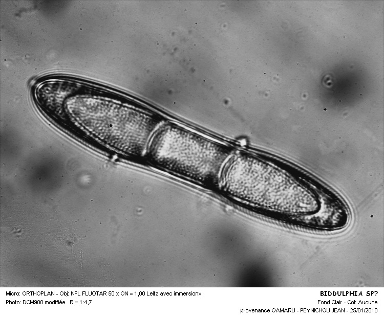 ANAULUS SUBCONSTRICTUS #32308
