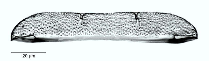Anaulus subconstrictus #53578