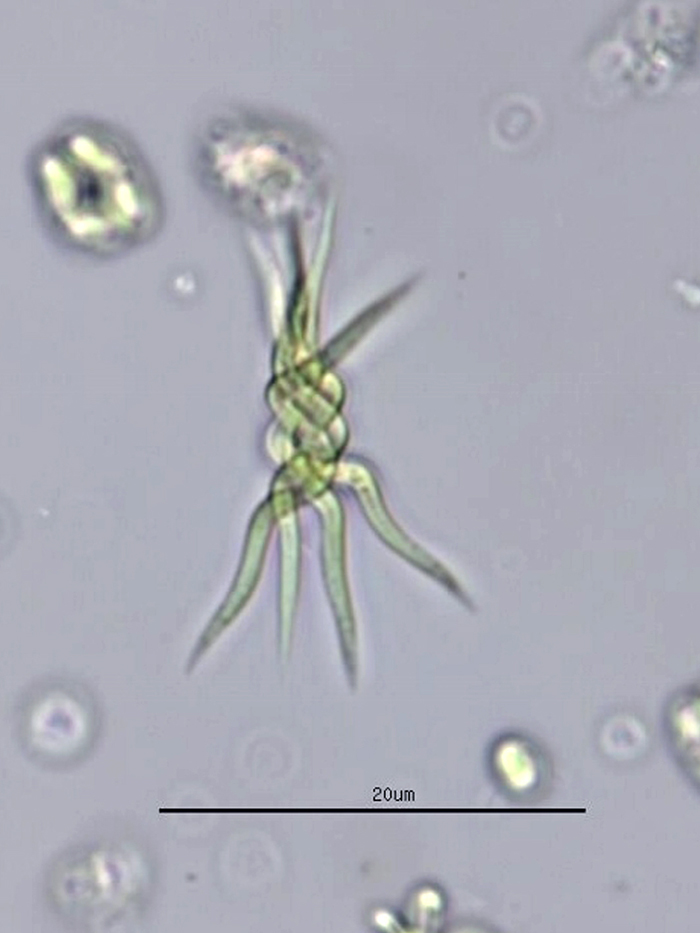 Ankistrodesmus spiralis #76484