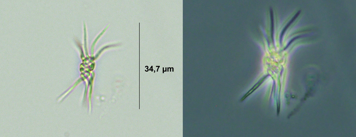 Ankistrodesmus spiralis #76483