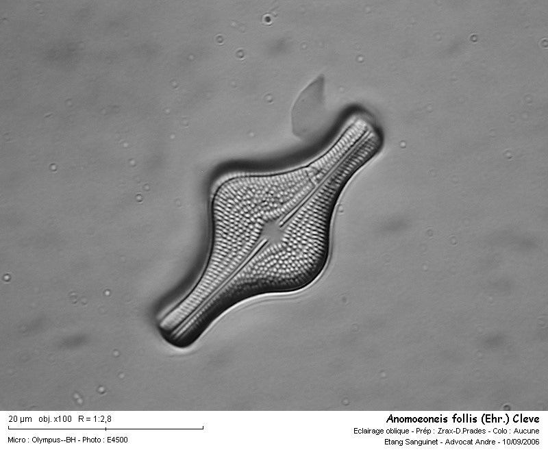 Anomoeoneis follis (Ehr.)Cleve #2131